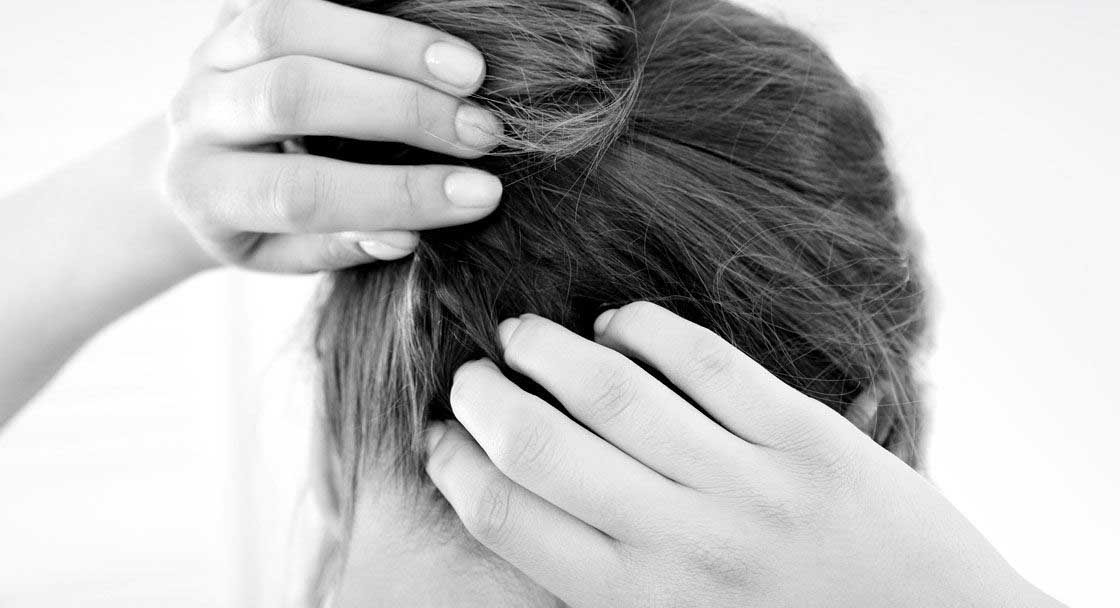 Hair Loss and Scalp Psoriasis… How to cope with this condition? - Vivandi  Trichology
