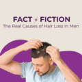 Fact vs. Fiction: The Real Causes of Hair Loss in Men