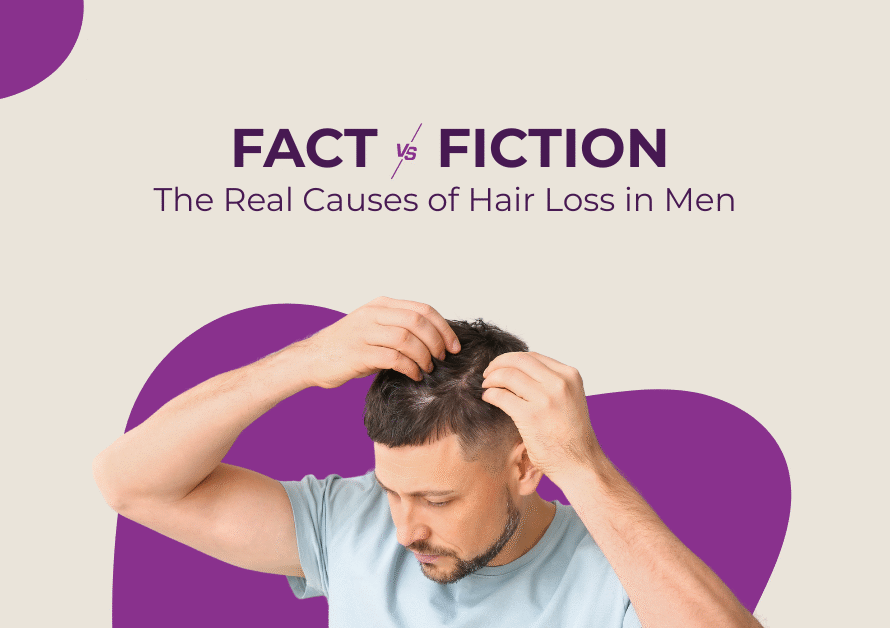 Fact vs. Fiction: The Real Causes of Hair Loss in Men