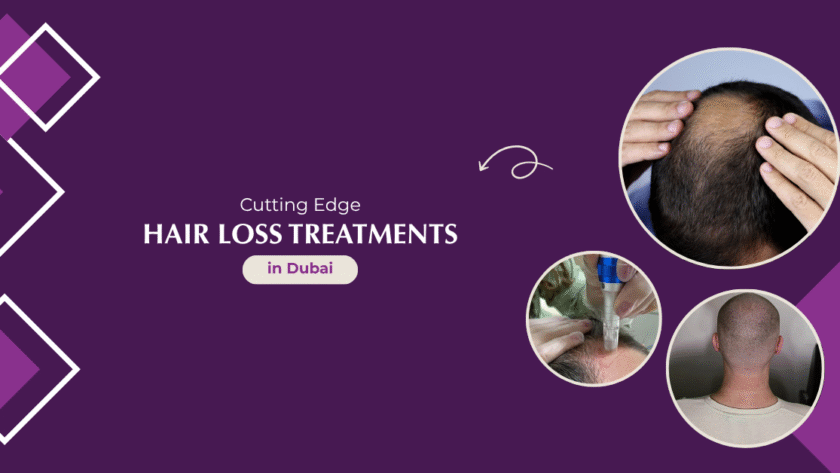 Hair Loss Treatments in Dubai