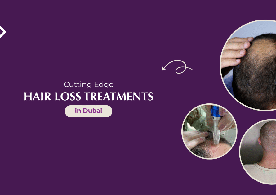 Hair Loss Treatments in Dubai