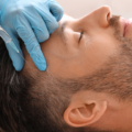 Best Hair Loss Treatments for Men in UAE – 2026