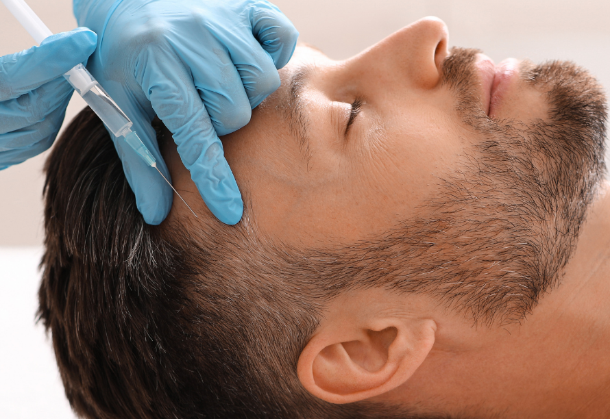 Hair Loss Treatments