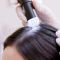 Hair & Scalp Analysis: What Happens During a Trichology Consultation