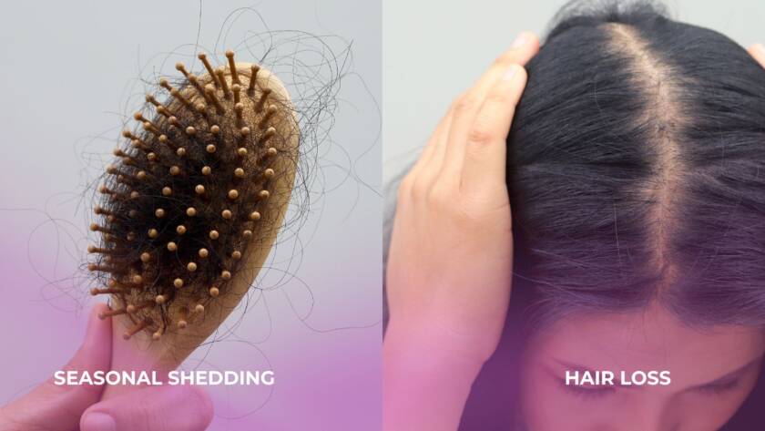 hair shedding