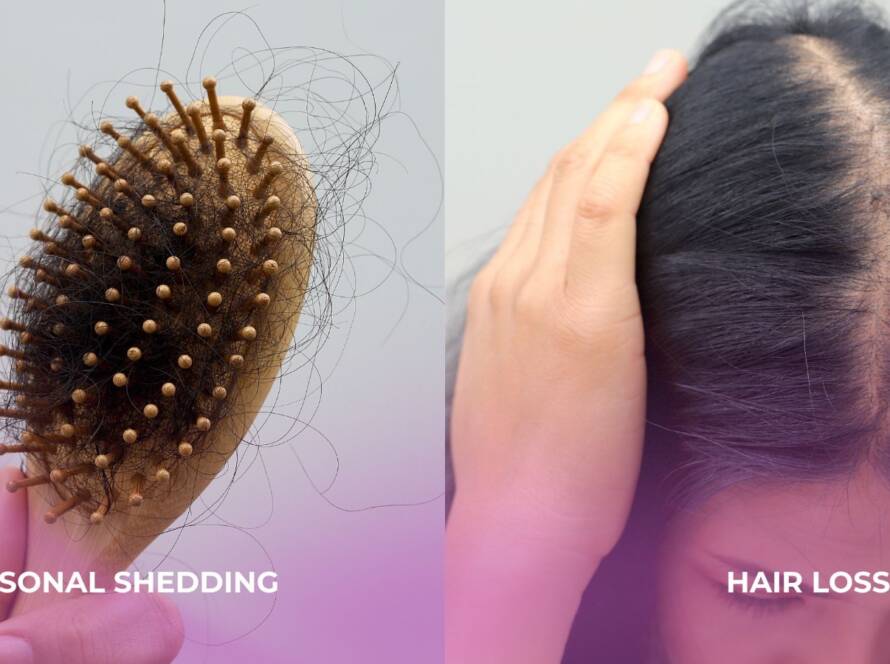 hair shedding