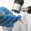Hair Trichologist: How to Find the Best Trichologist for Healthy Hair & Scalp