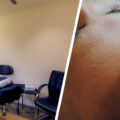How to Choose the Best SMP Clinic in the UAE: Expert Tips from Vivandi Trichology