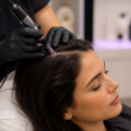 Microneedling for Hair Growth: Benefits, Process & How It Compares to Other Treatments