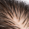 What Does a Healthy Scalp Actually Look Like? 7 Signs of Good Scalp Health